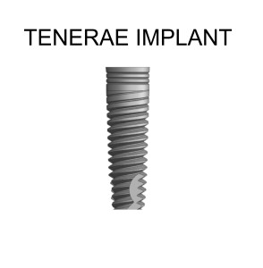 TENERAEW LOG